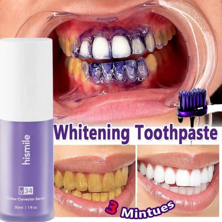 ✨ HiSmile V34 Purple Teeth Whitening Serum – Instant Stain Removal & Brighter Smile 💜😊