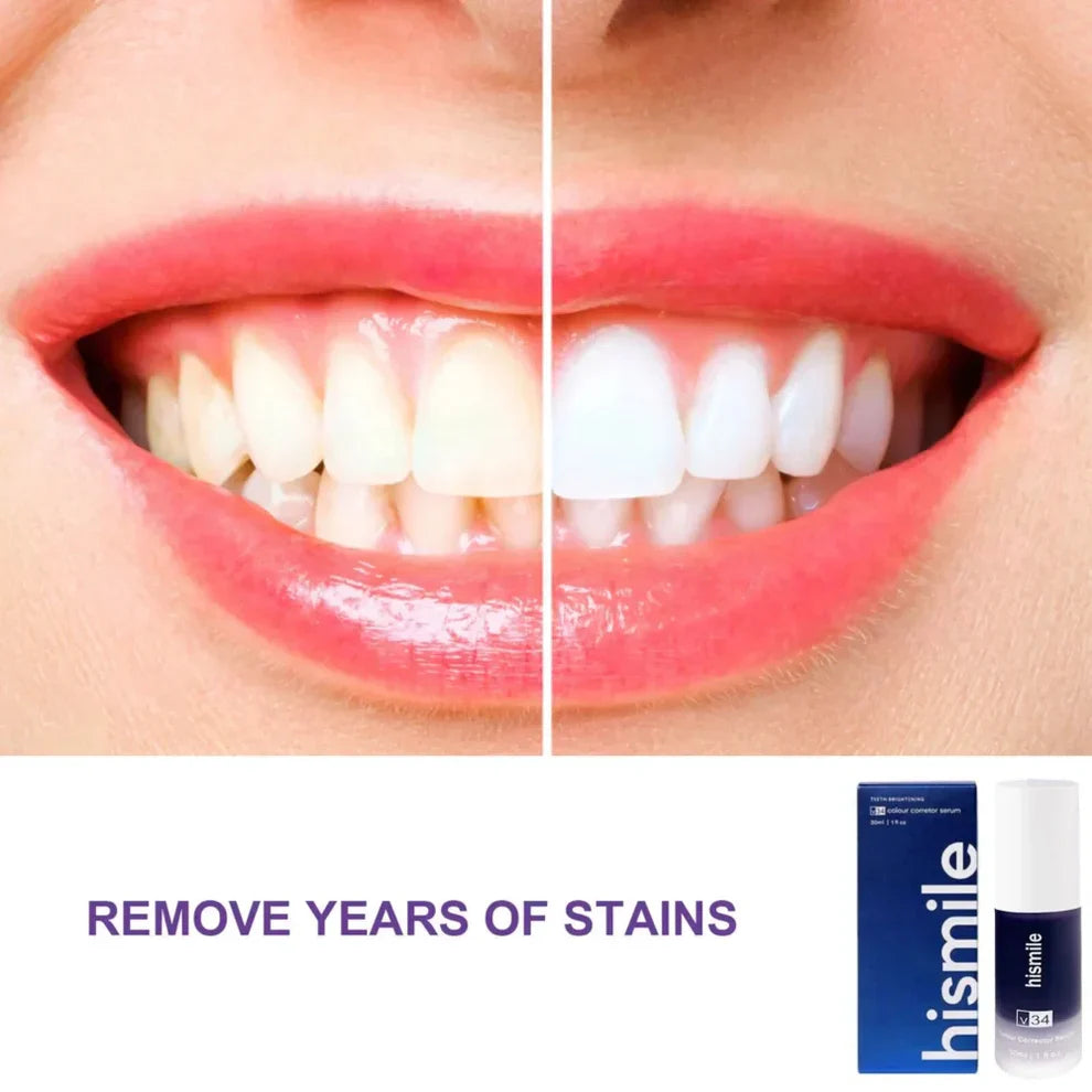 ✨ HiSmile V34 Purple Teeth Whitening Serum – Instant Stain Removal & Brighter Smile 💜😊